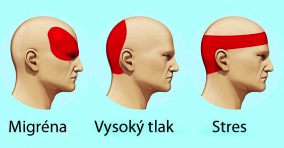 7b366012b66657d7fbbc038eae6a74ba